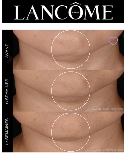 LANCÔME : Coffret   Rénergie  , Crème Anti-âge